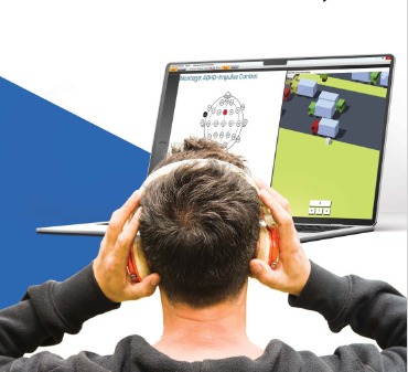 Why eStim2 neurotechnology ecosystem